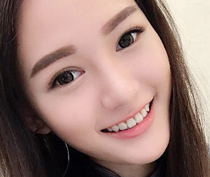 Ptosis Correction Levator Feature