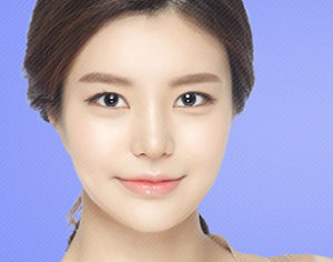 In double facelift, AccuSculpt and thread facelift complement each other and create a synergy effect for facelifts