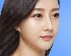 Long Chin Surgery korea
