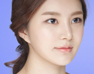 Zygoma Reduction In Korea